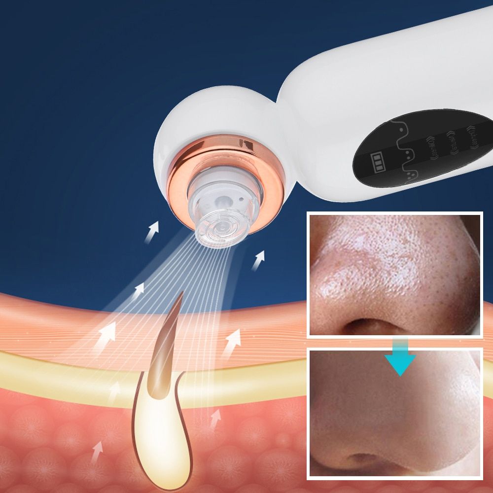 Blackhead Remover Vacuum Suction Small Bubble Pore Cleaner Device0 Pimple Extractor Microdermabrasion Electric Face Nose Cleaser