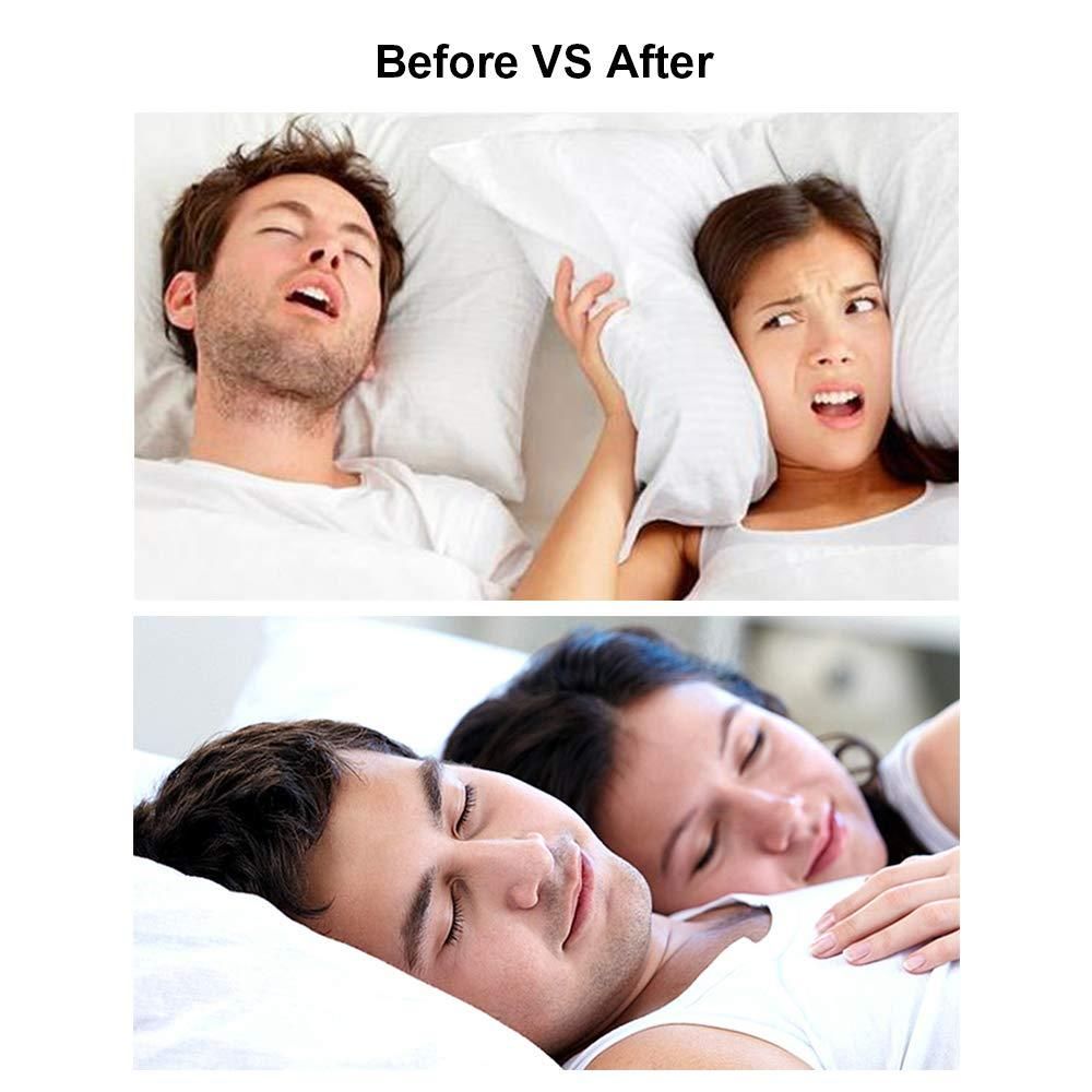 Anti Snoring Nasal Dilators Reduce Snore Nasal Congestion Relief for Better Breathing & Sleeping