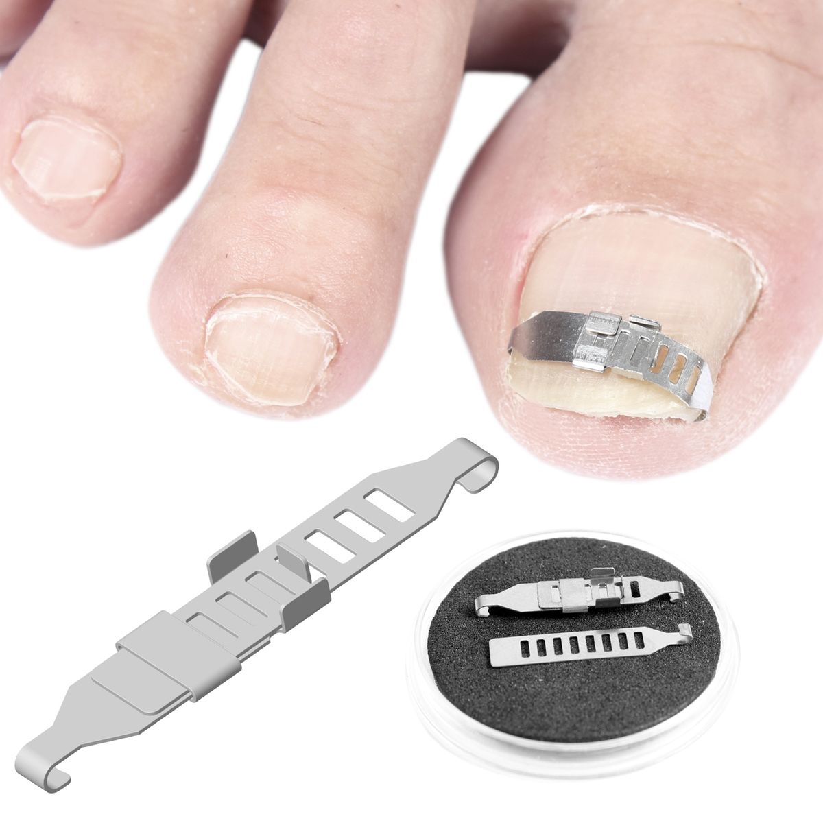 Ingrown Toenail Tools Kit Nail Pedicure Corrector Ingrown