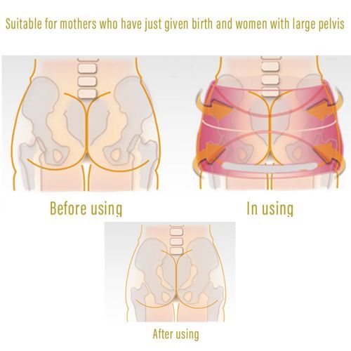 Postpartum Girdle Body Recovery Pelvic Bone Belt Correction Tape With Airbag Pneumatic Type Pelvic Zone Women Postpartum Belt(#Black)