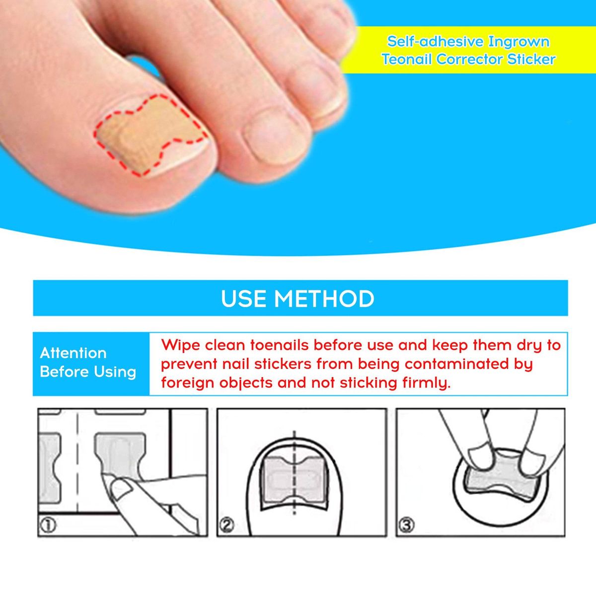 120Pcs Jelly Glue Self-adhesive Ingrown Teonail Corrector Stickers Simple Paste Daily Replacement Ingrown Teonail Corrector Tool