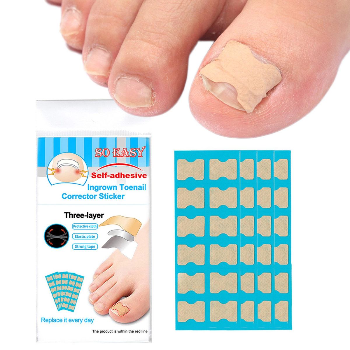 120Pcs Jelly Glue Self-adhesive Ingrown Teonail Corrector Stickers Simple Paste Daily Replacement Ingrown Teonail Corrector Tool