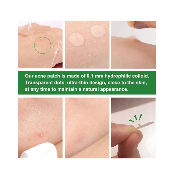 24 Patches Acne Pimple Patch Invisible Acne Removal