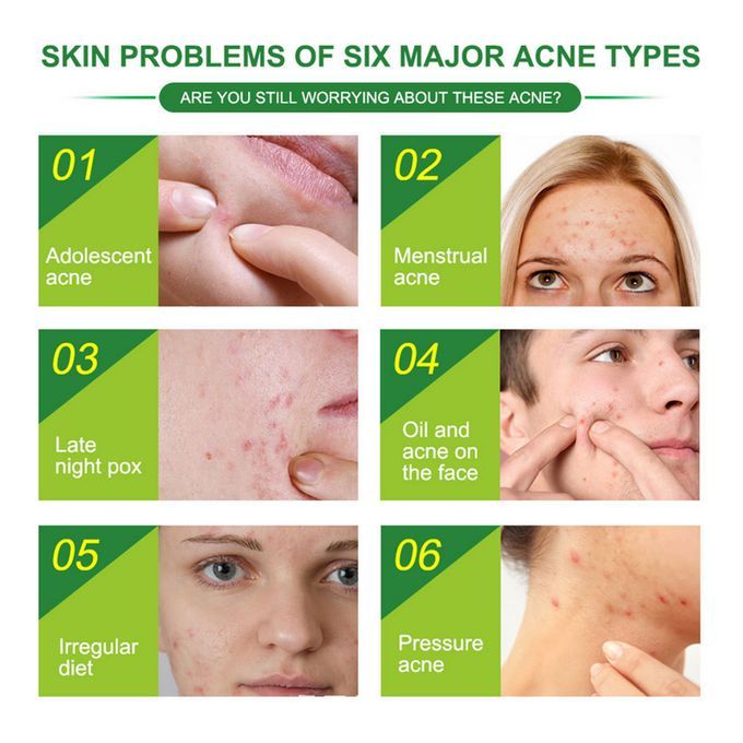 24 Patches Acne Pimple Patch Invisible Acne Removal