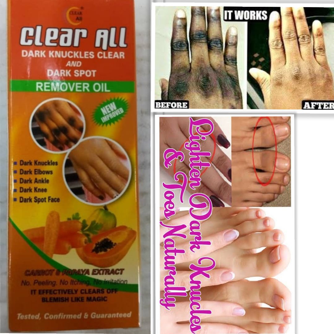 Clear All Dark Knuckles Clear And Dark Spot Remover Carrot & Papaya Oil