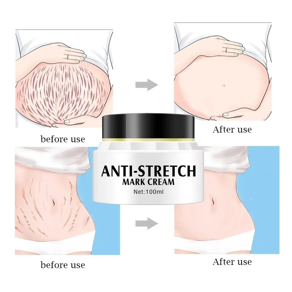 Medical Formula Anti Stretch Mark Cream
