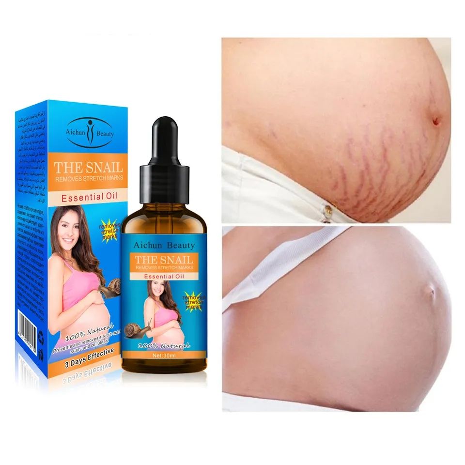 Snail Stretch Mark Remover Essential Oil
