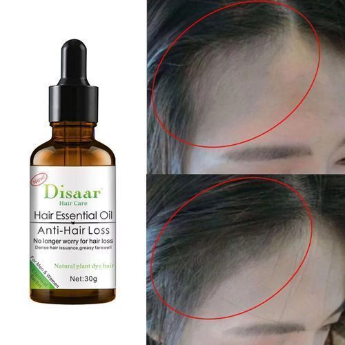 Baldhead, Edge And Rapid Hair Growth Essential Oil