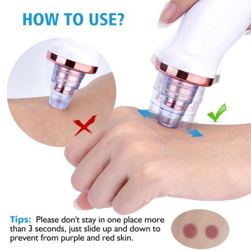 Electric Blackhead & Pimple Remover With 5 In 1 Pimple Zit