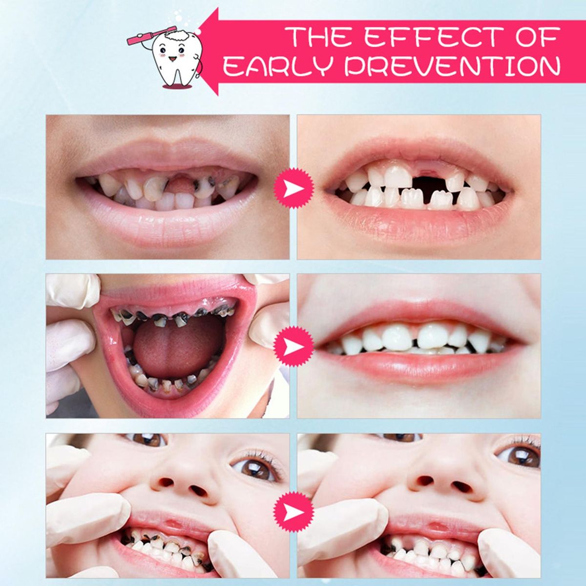60ml Tooth Cleaning Mousse Toothpaste Fresh Teeth Oral Hygiene Removes Plaque Stains Dental Tool
