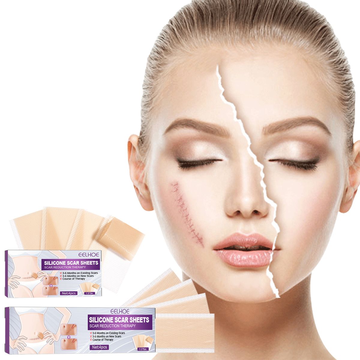 4Pcs Adhesive Silicone Scar Sheets Safety