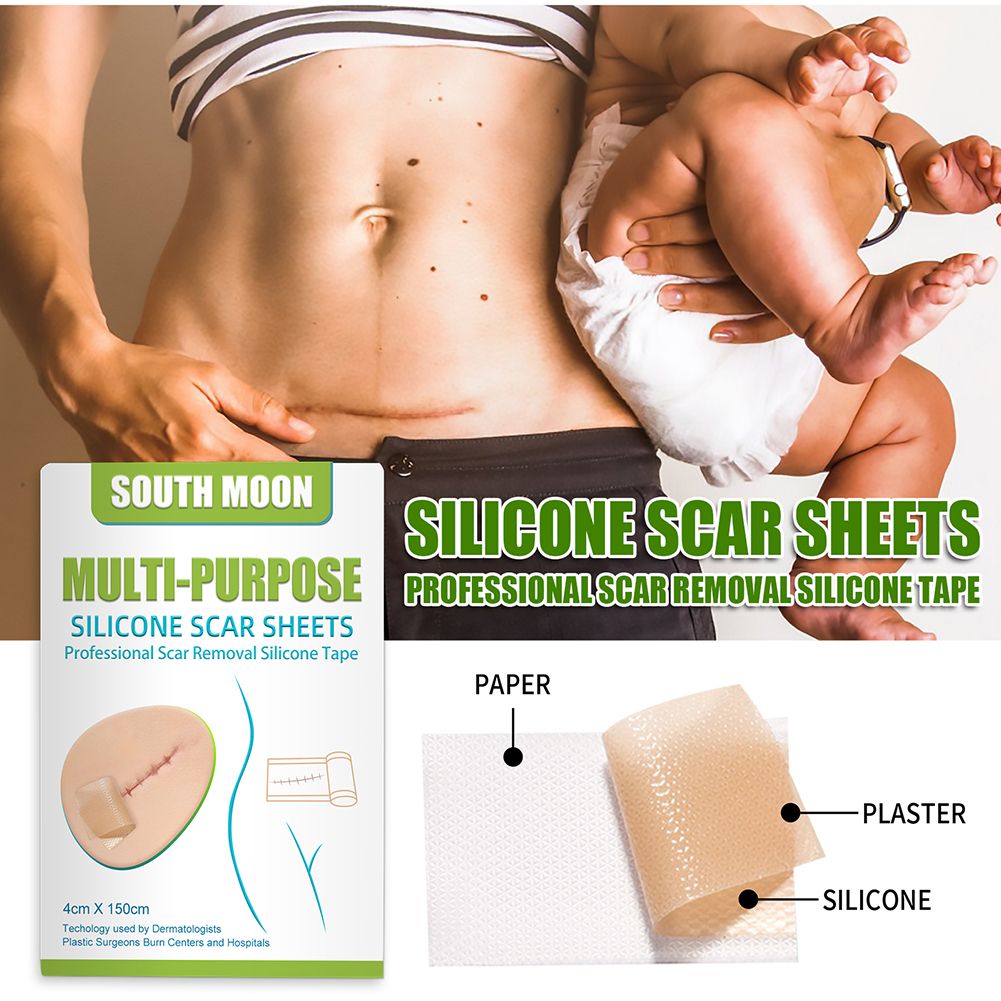 150cm Scar Removal Stickers Professional Multipurpose
