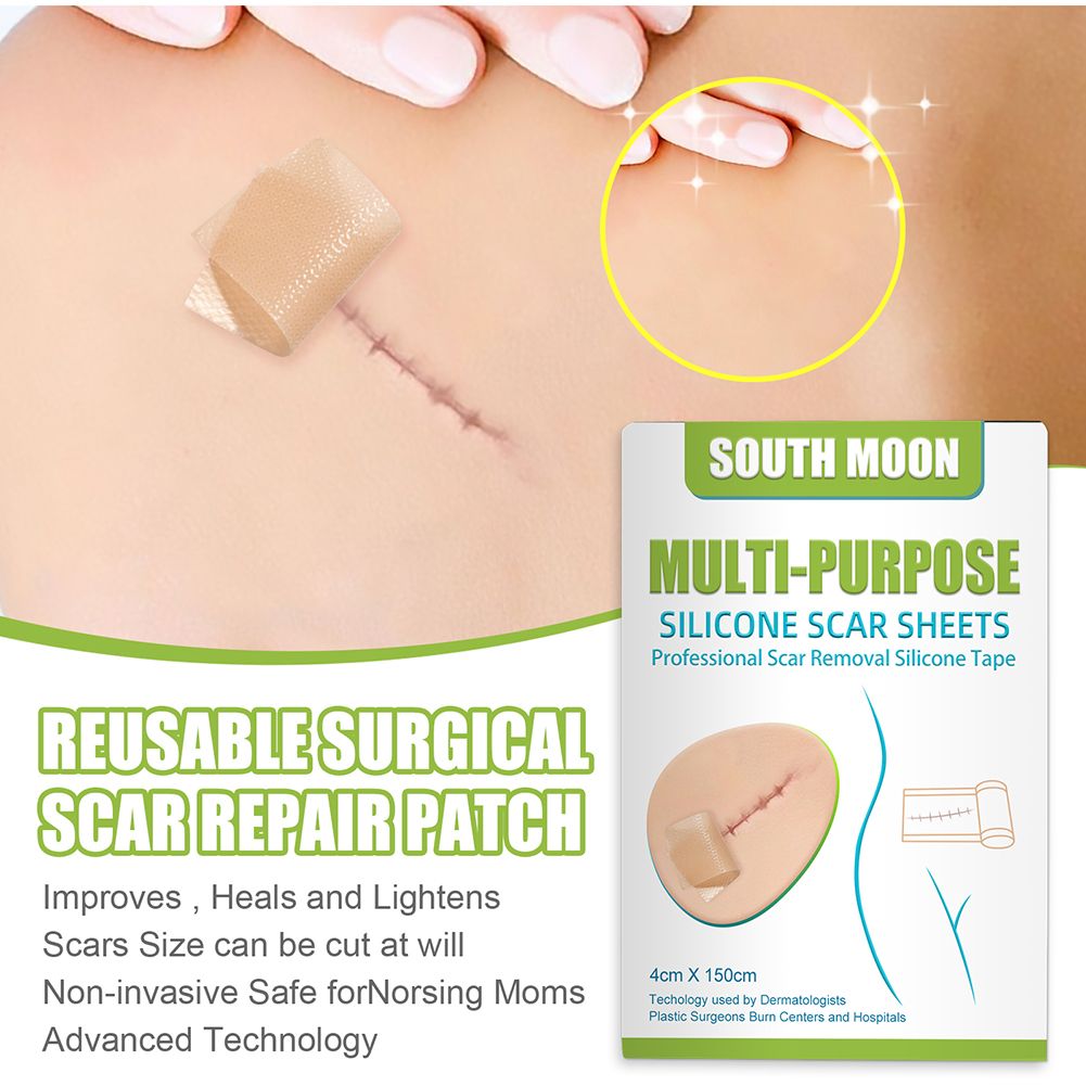 150cm Scar Removal Stickers Professional Multipurpose