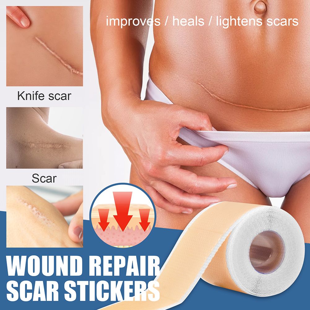 150cm Scar Removal Stickers Professional Multipurpose