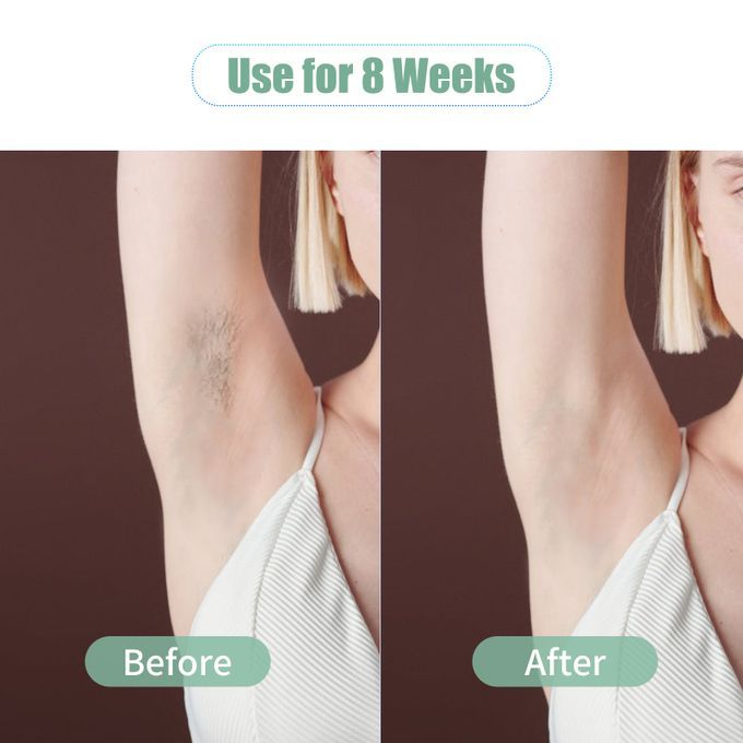 Permanent Laser Hair Remover IPL Laser Hair Removal Device