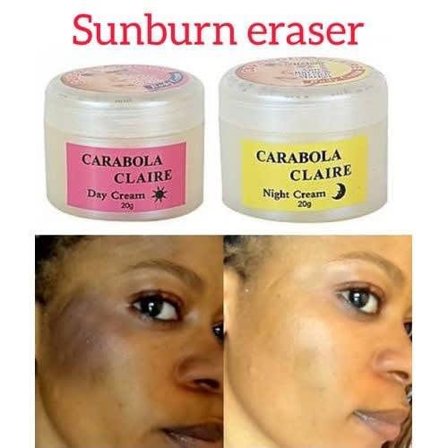 Carambola Sunburn Removal Cream (Day & Night Cream)