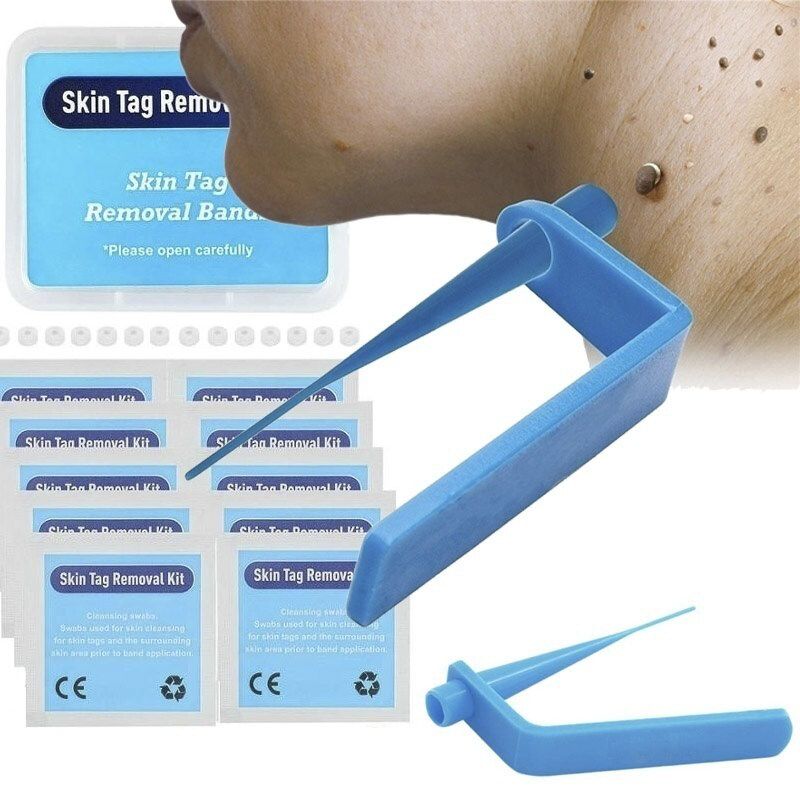 Micro Skin Tag Remover Kit For Home Use Small To Medium Skin Tags Body Effective Mole Wart Remover Skin Tag Remoal Band