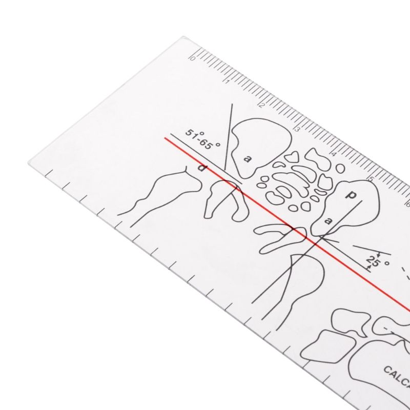 C90D Goniometer Angle Medical Ruler Rule Joint Orthopedics