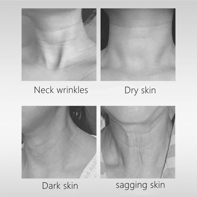 Neck Beauty Device Removal Double Chin Therapy Facial