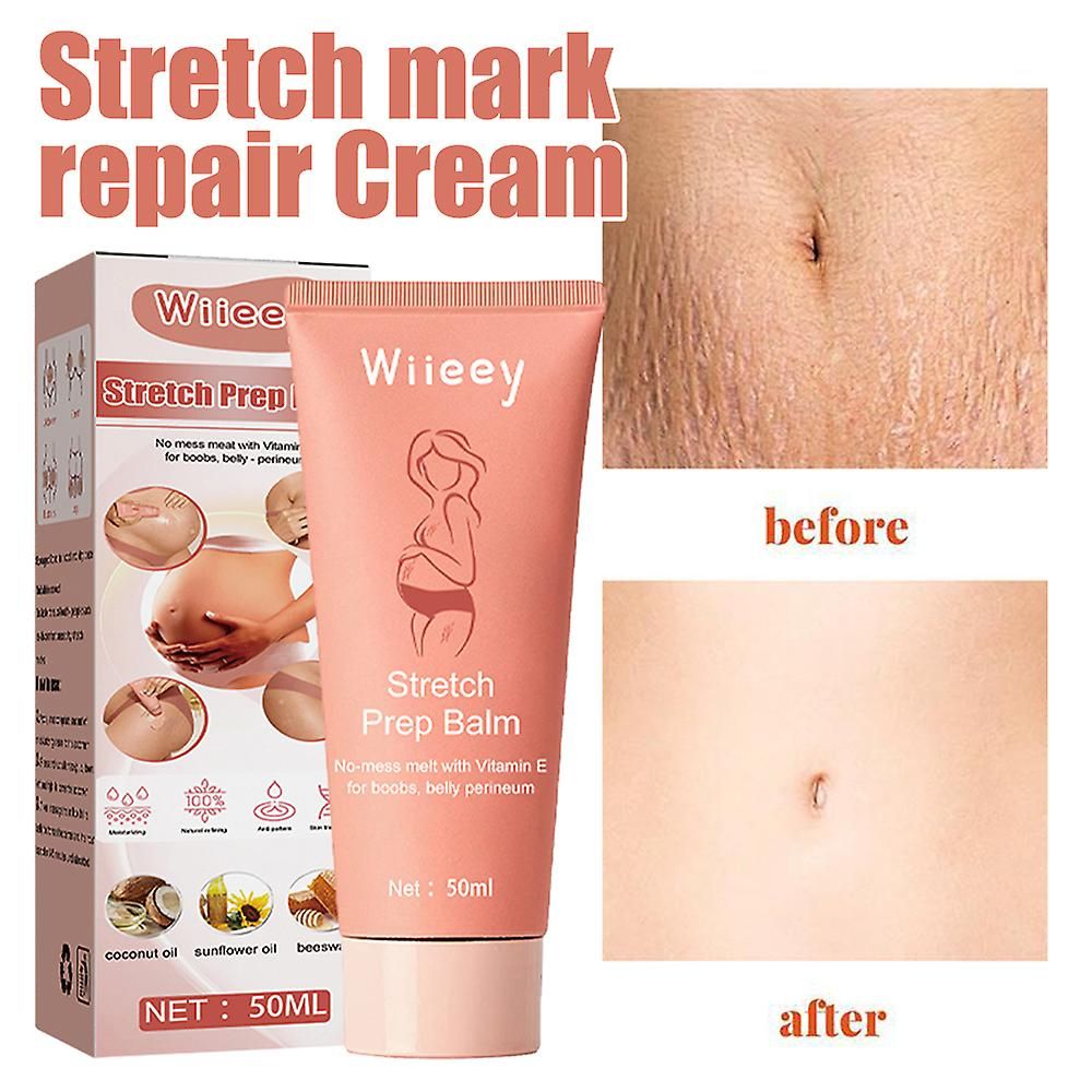 Stretch Prep Balm, Pregnancy Marks Firming Massage Body Gel