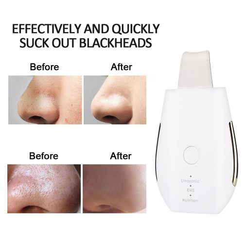 Skin Care Blackhead Remover Tools Beauty Products Skincare Acne Face Cleaner Plasma Ultrasonic Skin Scrubber Dropshipping Center