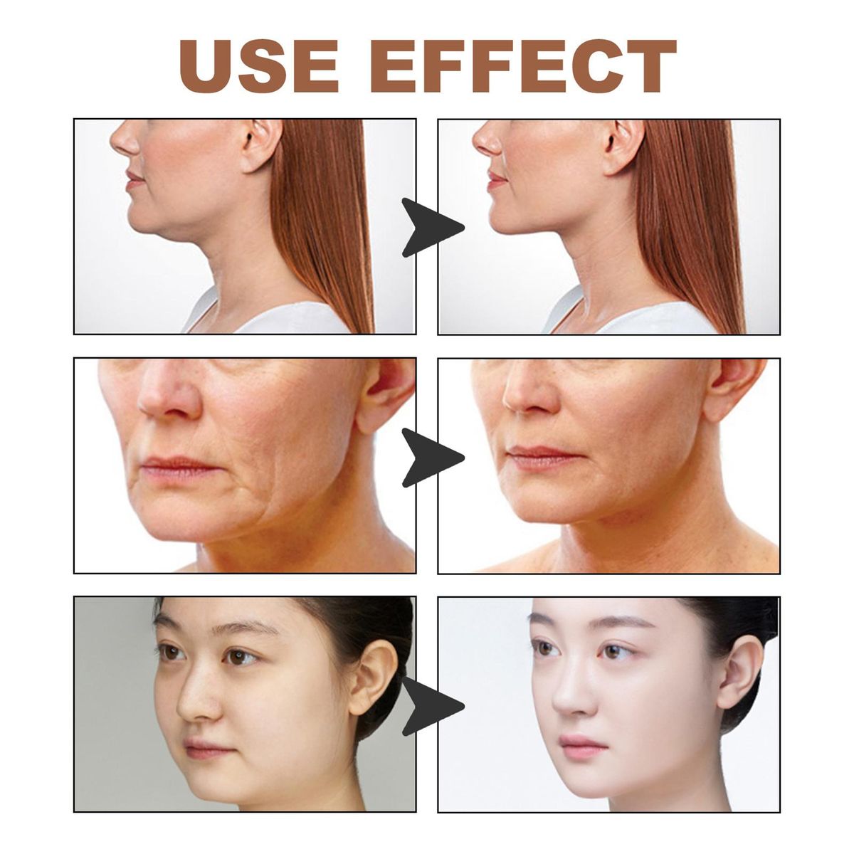 EELHOE F-acial A-nti Sagging Lifting Patch Slimming S-trap Double Chin Reducer Portable