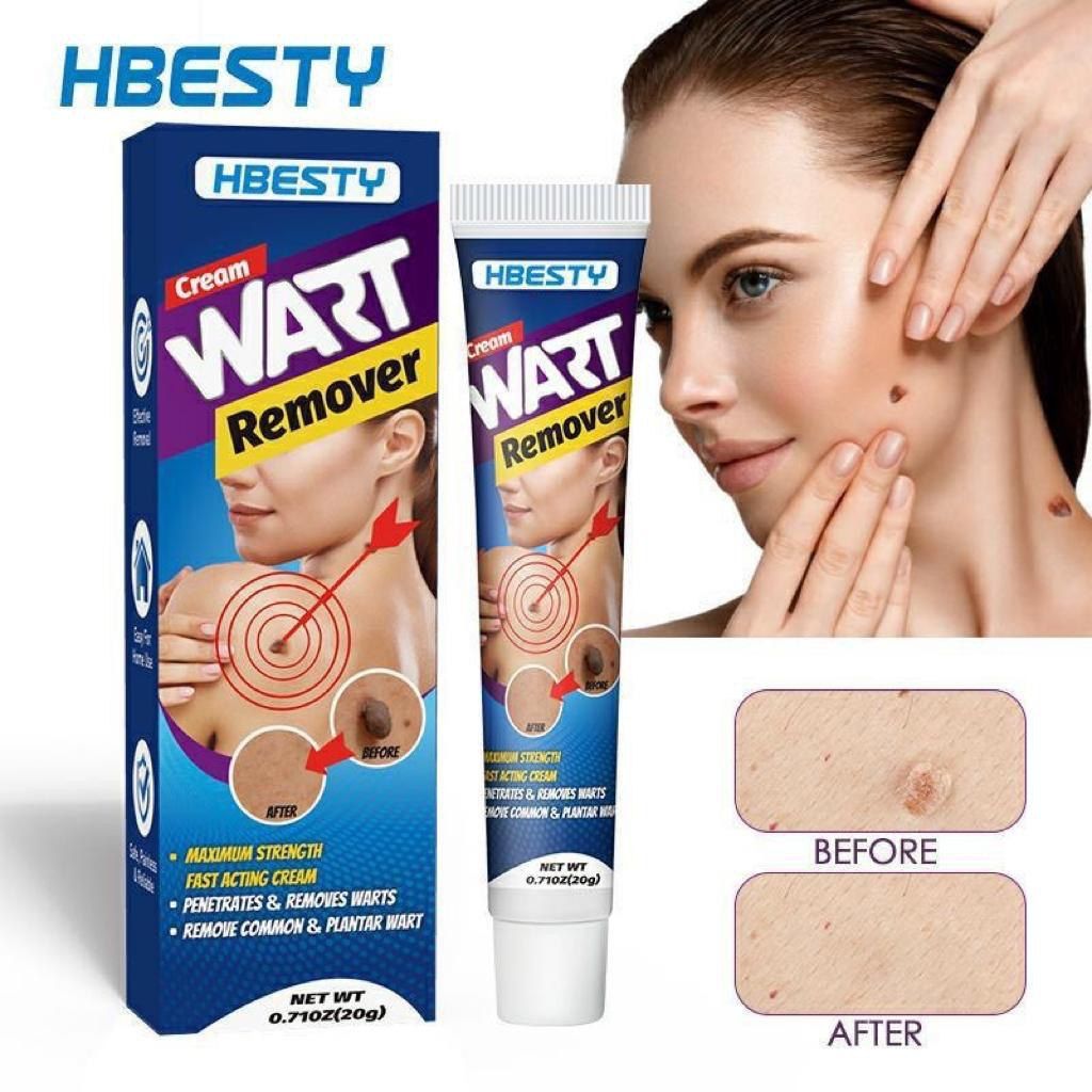 Fast Acting Herbal Wart Removal Ointment Cream