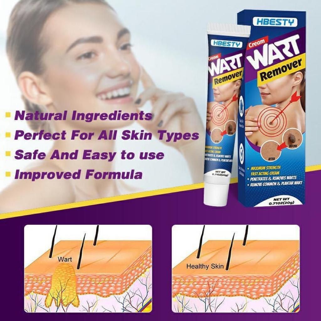 Fast Acting Herbal Wart Removal Ointment Cream
