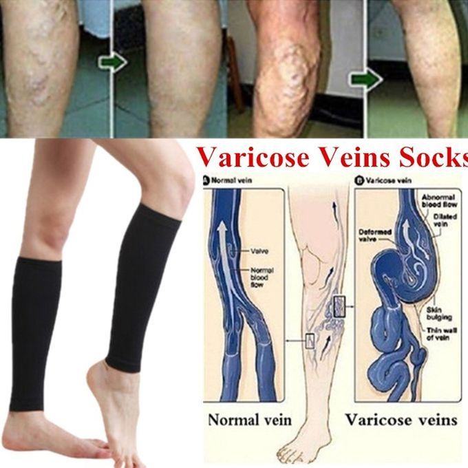 Alf  Ompression Sleeves Leg  Ompression So Ks Shin Splint  Alf Pain Relief-Black