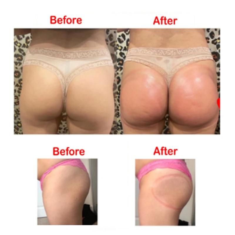 2PCS Dia 21 cm 180Ml Buttock Sucker Vacuum Stimulator