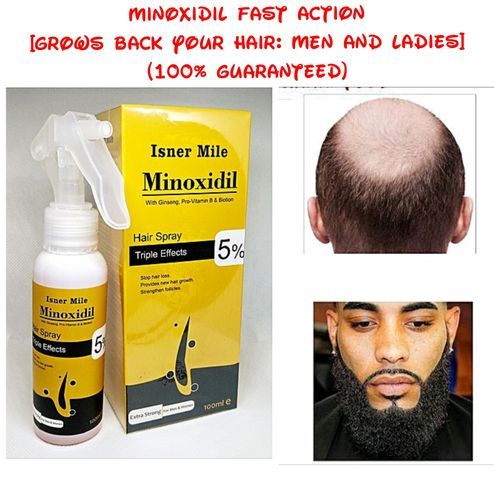Minoxidil 5% For Baldness/Beard Hair Growth For Men/Women