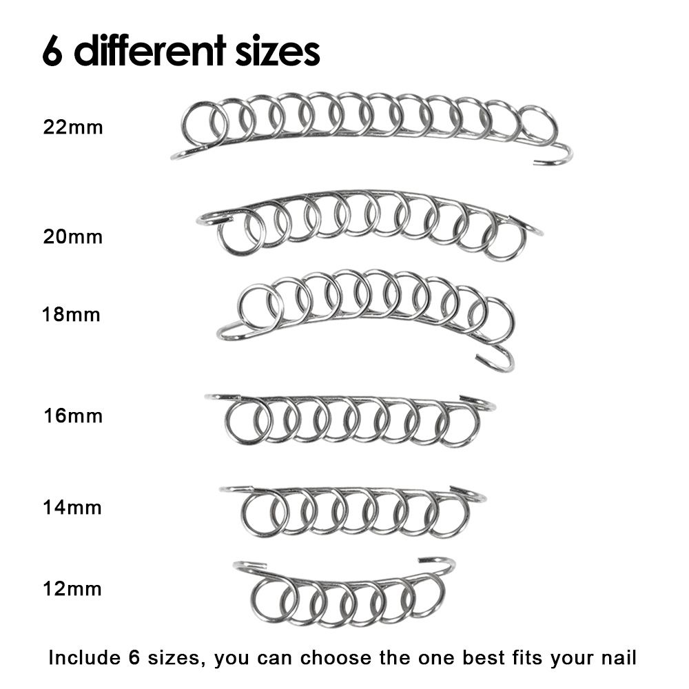12Pcs Ingrown Toenail Correction Wire Fixer Ingrown Toe