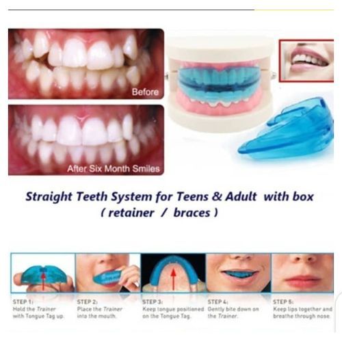 2PCS Silicone Tooth Orthodontic Appliance Trainer Alignment Denta Blue( Teeth Corrector)