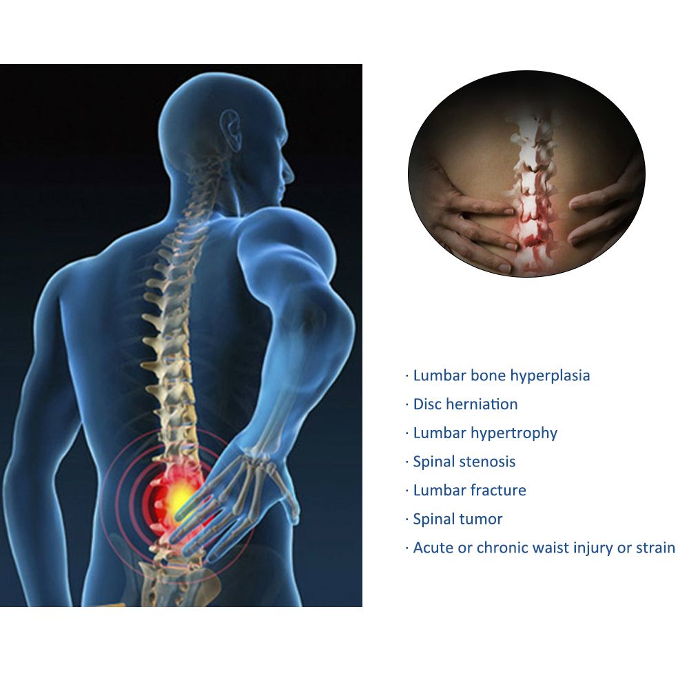 Patch Medical Packs Back Orthopetic Herbs Relief 12pcs/2 Medicine Plaster Magnetic Waist Lumbar Chinese Pain Hyperosteogeny Pain
