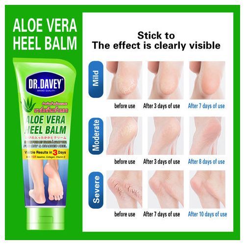 Foot Cream For Rough Dry & Cracked Heel Balm 100g