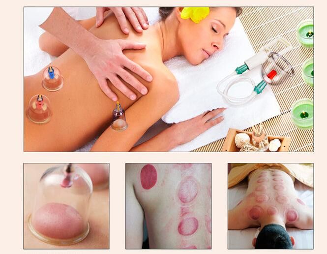 Chinese Vacuum Massagers Relax High 32 Kit Suction Cups A Pull Out Quality Pumps Curve Cans Vacuum Therapy Cupping Pcs Apparatus