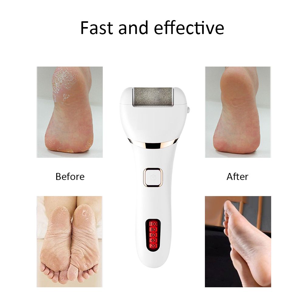Electric Foot Callus Removers Portable Rechargeable Pedicure