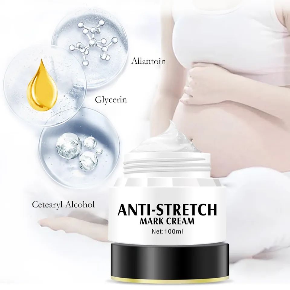 New Hot Postpartum Stretch  Marks Repair Cream