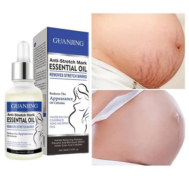 ANTI STRETCH MARK ESSENTIAL OIL