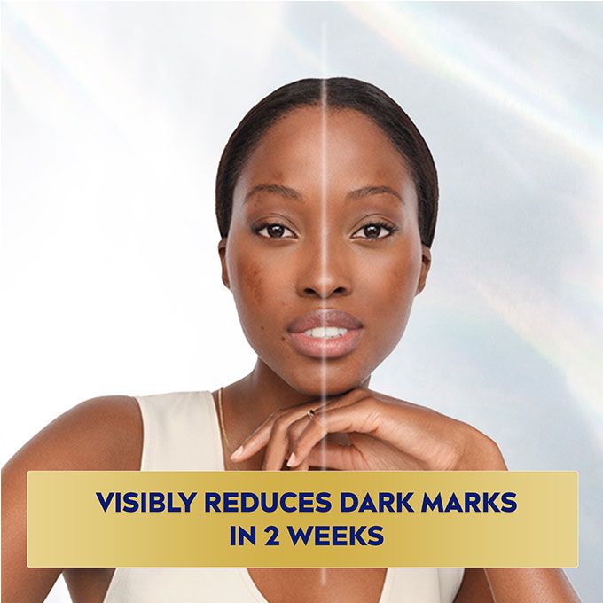 Perfect & Radiant Luminous630 Anti Dark Marks Serum - 30ml (Pack of 2)