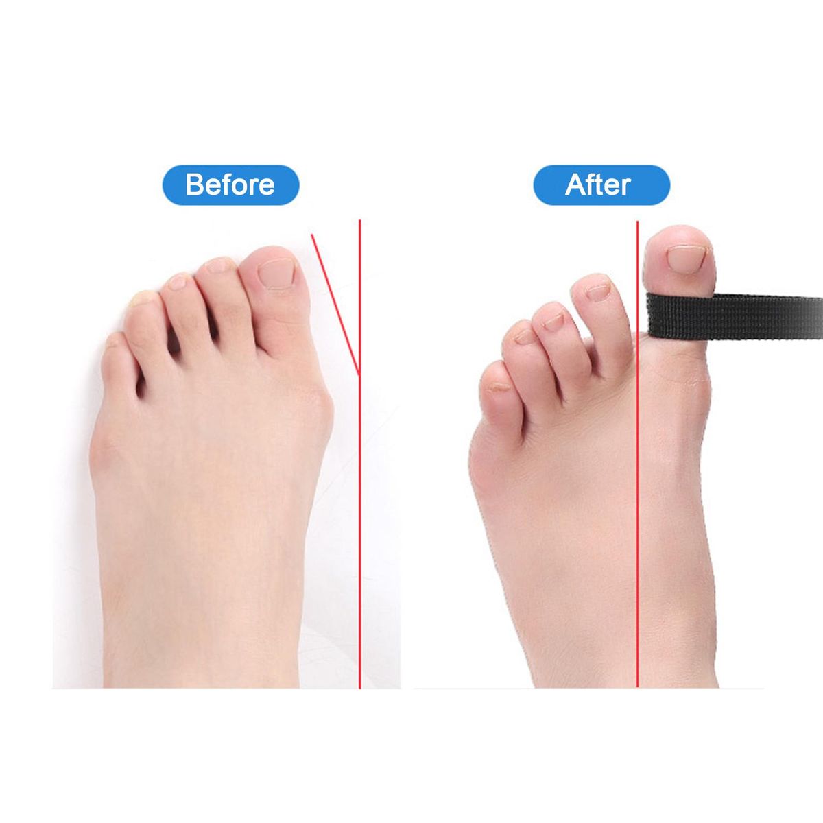 Toe Corrector Bunion Toe Straightener Big Toe Strap Bunion Relief Toe Stretcher Alignment Corrector