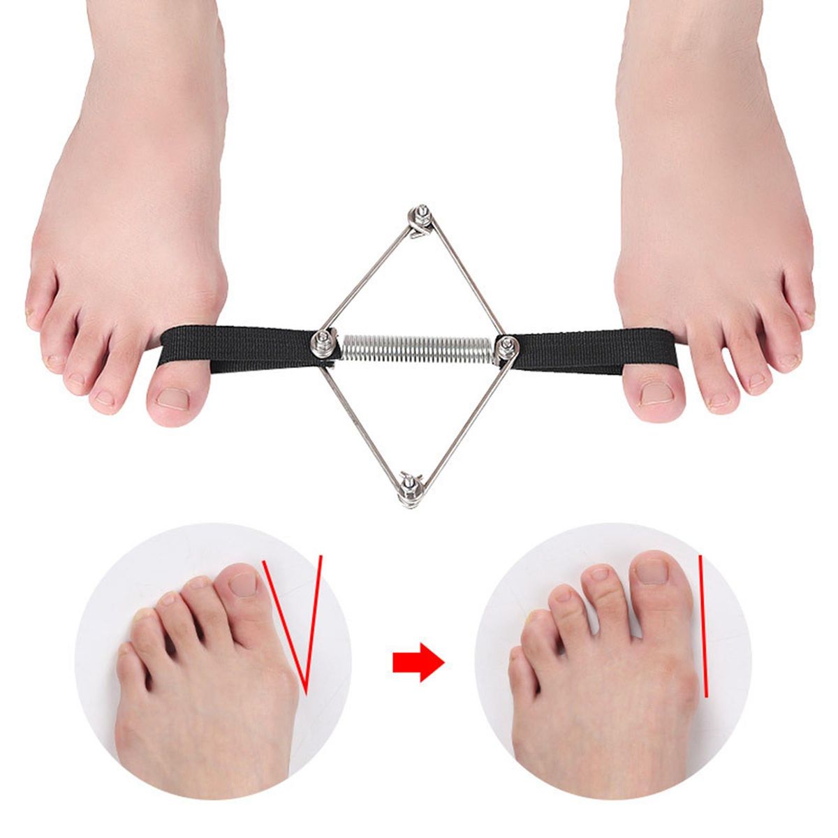 Toe Corrector Bunion Toe Straightener Big Toe Strap Bunion Relief Toe Stretcher Alignment Corrector