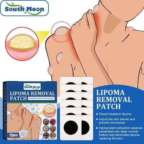 SOUTH MOON 12Pcs Lipoma Removal Patch Reduce Swelling Pain Relief
