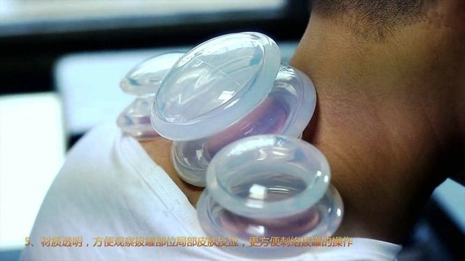 Body Anti Transparent Clearing Cups Cellulite Suction Cup Damp Cupping Vacuum Beauty Helper Massage Silicone Slimming 4pcs