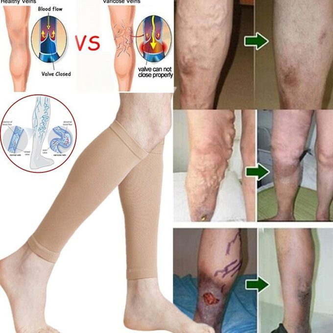 Alf  Ompression Sleeves Leg  Ompression So Ks Shin Splint  Alf Pain Relief-Skin