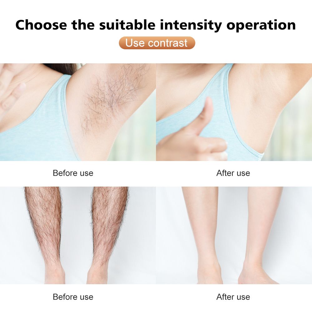608000 Flashes IPL Permanent Photon Epilator Hair Removal Device With 5 Energy Levels-N11-White