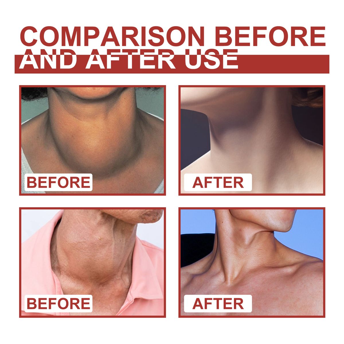 7Pcs Lymphatic Detox Patches Neck/Armpit