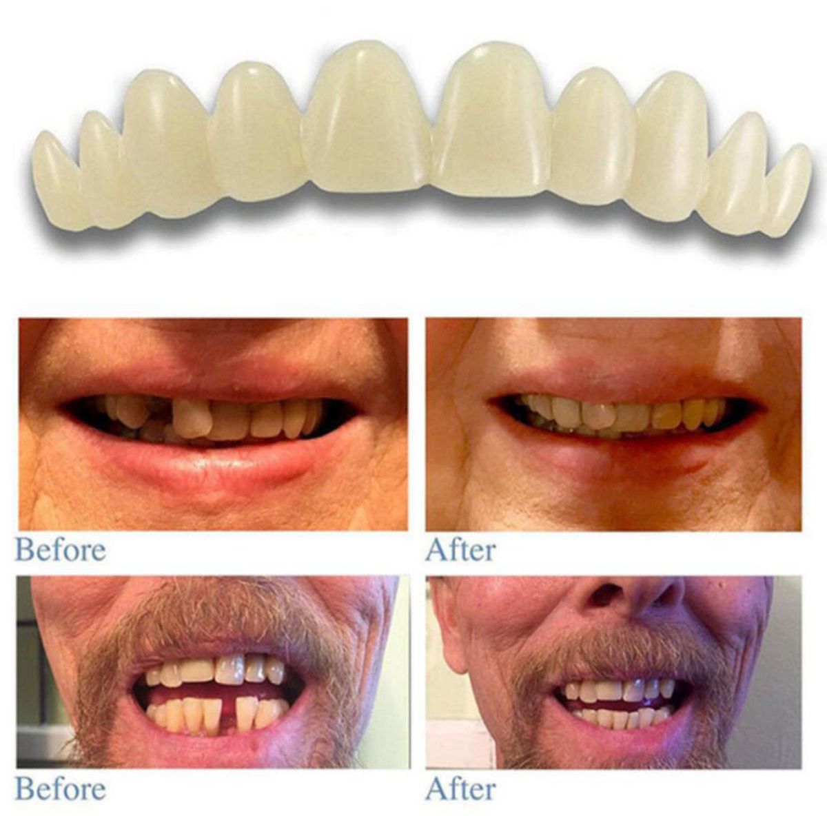 3pcs Silicone Reusable Teeth Veneers With Fitting Beads Temporary