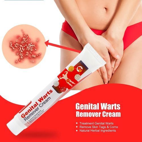 SOUTH MOON Effective Genital Warts Removal Cream