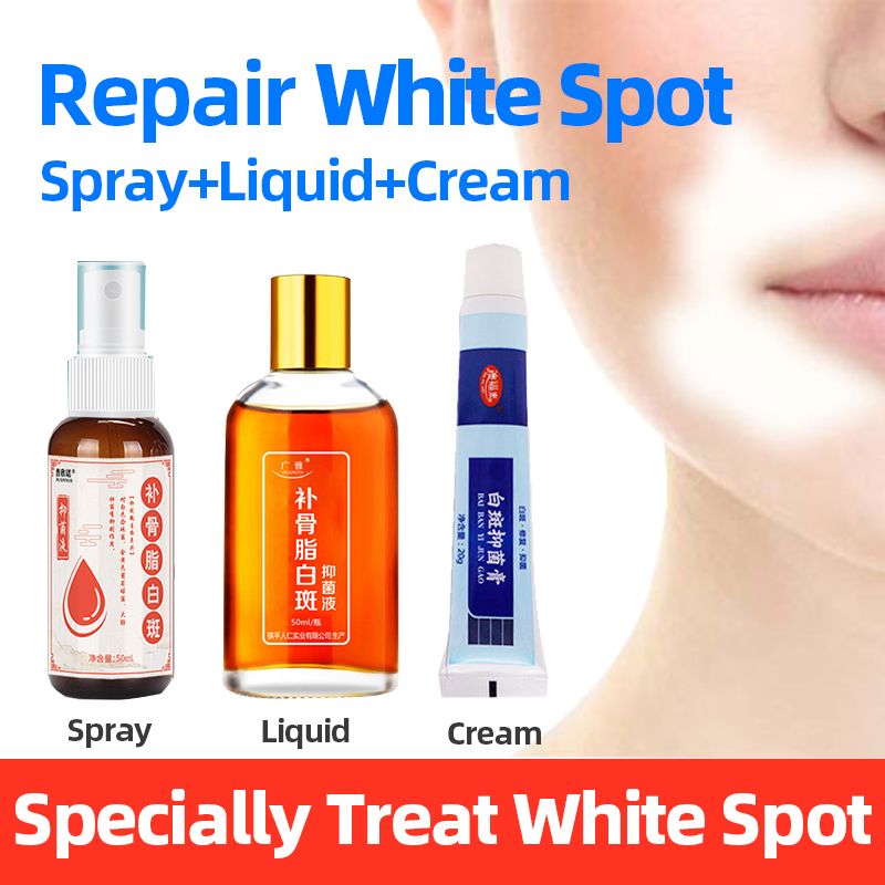 Spray Vitiligo Spray Foot Disease Repair Hand And Chinese Medical Liquid Hebal White Antibacterial Leukoplakia Treatment Spot